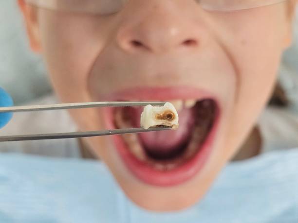 Best Emergency Dental Services for Seniors in Harrisburg, NC
